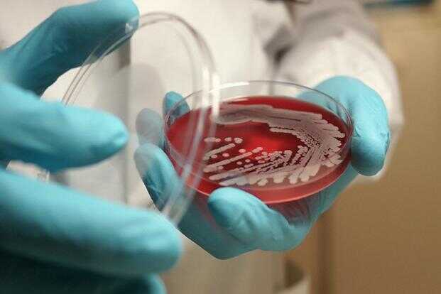 До 15 человек увеличилось количество заболевших менингитом в Екатеринбурге