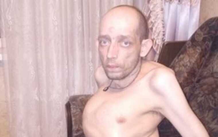 ФСИН вынес смертный приговор инвалиду I группы