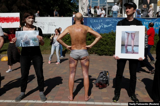 Пострадавший от пыток задержанный Артем Пронин (в центре) на акции против насилия силовиков в Минске 15 августа 2020 года. Фото: Reuters dqxikeidqxizsld