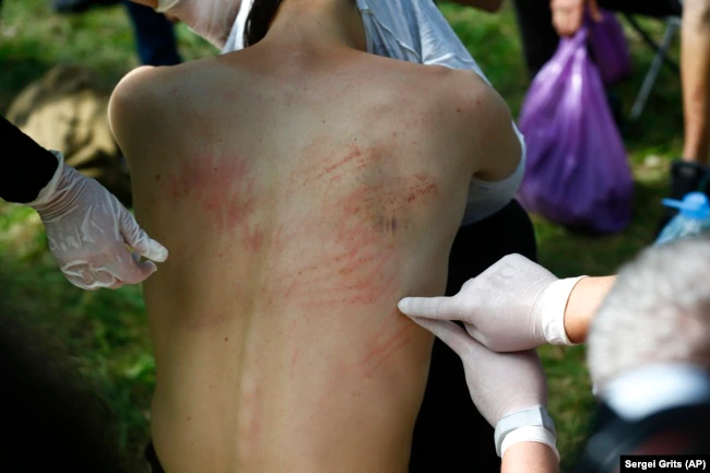 Медики осматривают пострадавшего мужчину после освобождения из изолятора в Минске, 14 августа 2020 года. Фото: AP