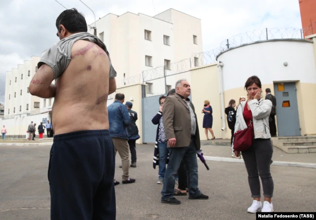 Задержанный Вартан Григорян, избитый в изоляторе на Окрестина в Минске, 13 августа 2020 года. Фото: ТАСС